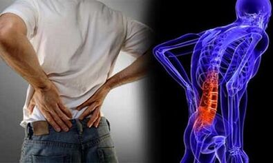 Reasons for the development of lumbar osteoarthritis
