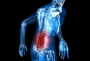 What is lumbar spine degeneration