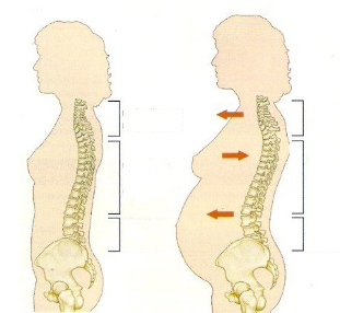 bone necrosis during pregnancy