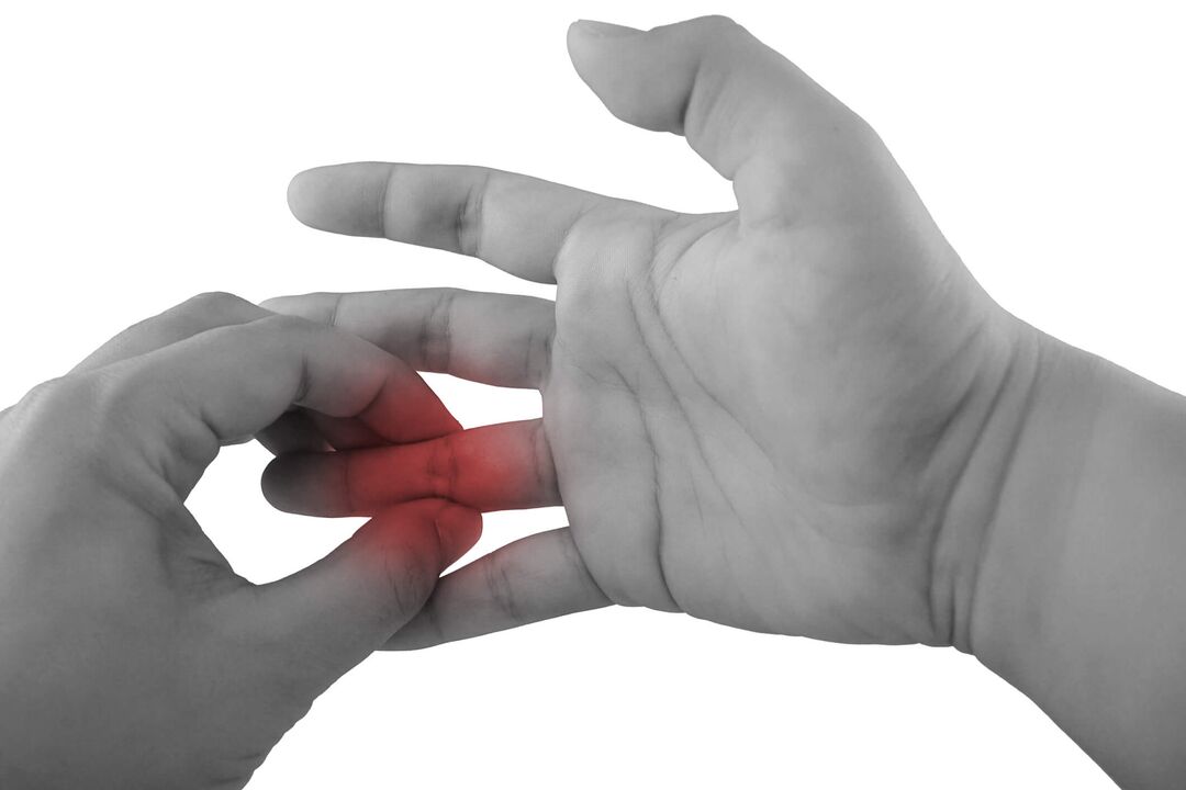 Finger arthritis is the cause of pain