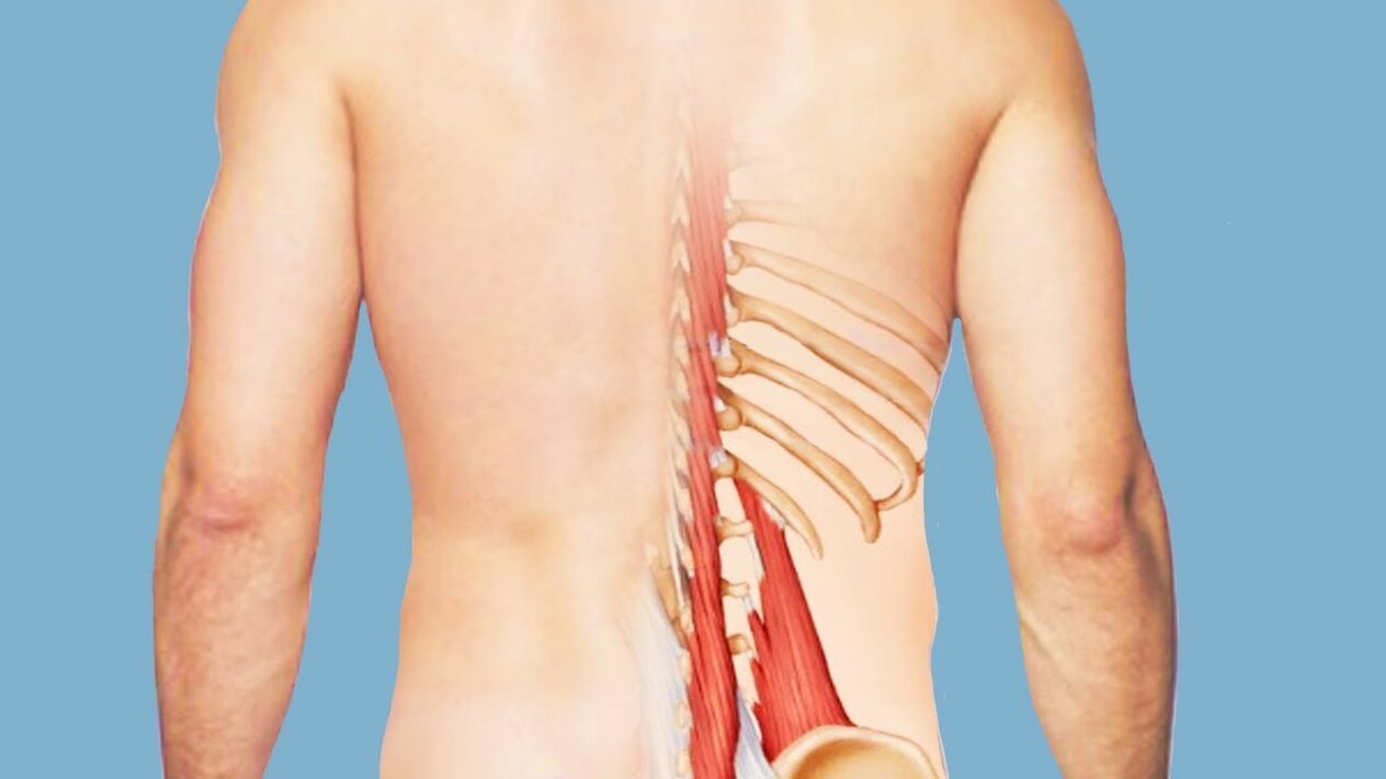 Myositis is the cause of back pain